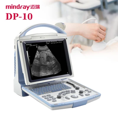 Mindray Dp10 Tragbares Ultraschallgerät, Echograph-Ultraschallsystem