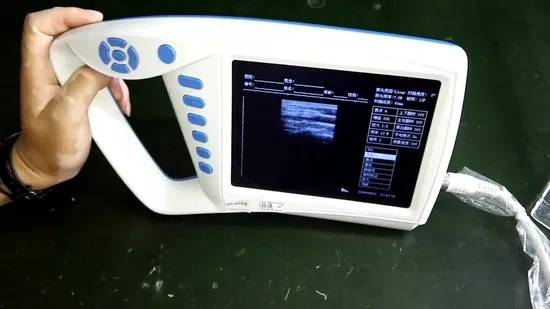 Volldigitaler S/W-Trolley-Ultraschallscanner, Diagnose-Sonar Yj